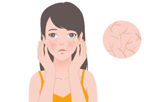 娜特护霜：修护敏感肌肤重塑健康屏障AG真人百家家乐APP第二代薇诺(图2)