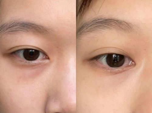 ！眼霜攻略分享十大淡纹排行推荐AG真人抗皱眼霜排行榜前十强(图13)
